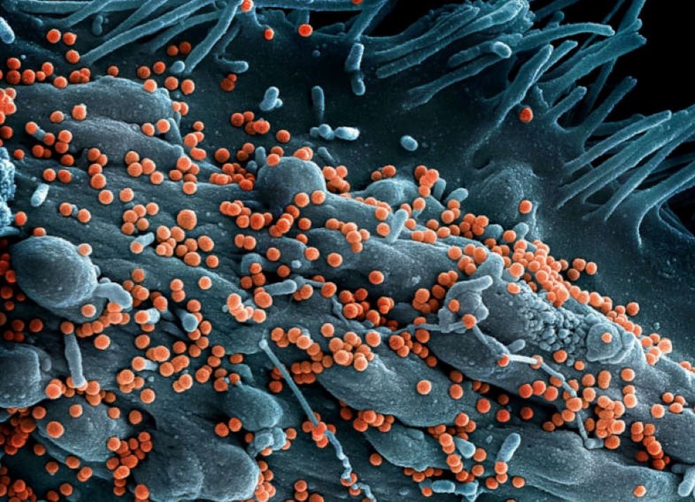 Scanning electron micrograph of Lassa virus budding off a cell.
